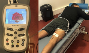 Surface electromyography implementation in football players rehabilitation after lower limb surgery